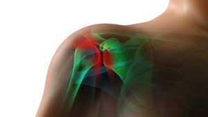 Is there a link between diabetes and frozen shoulder?